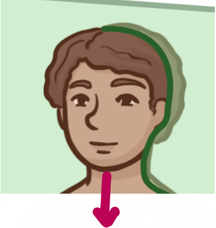<p>Which brain-body orientation is this</p>