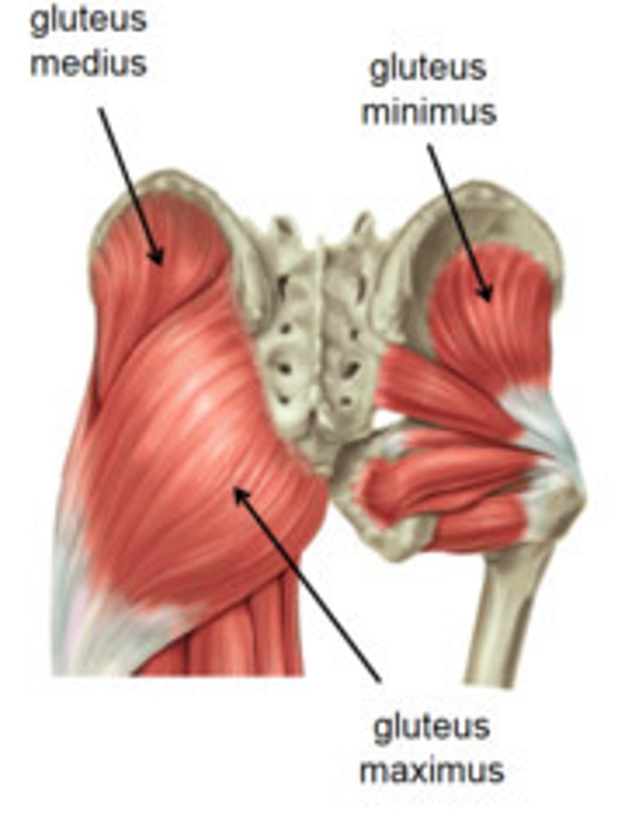 <p>greater trochanter of femur</p>