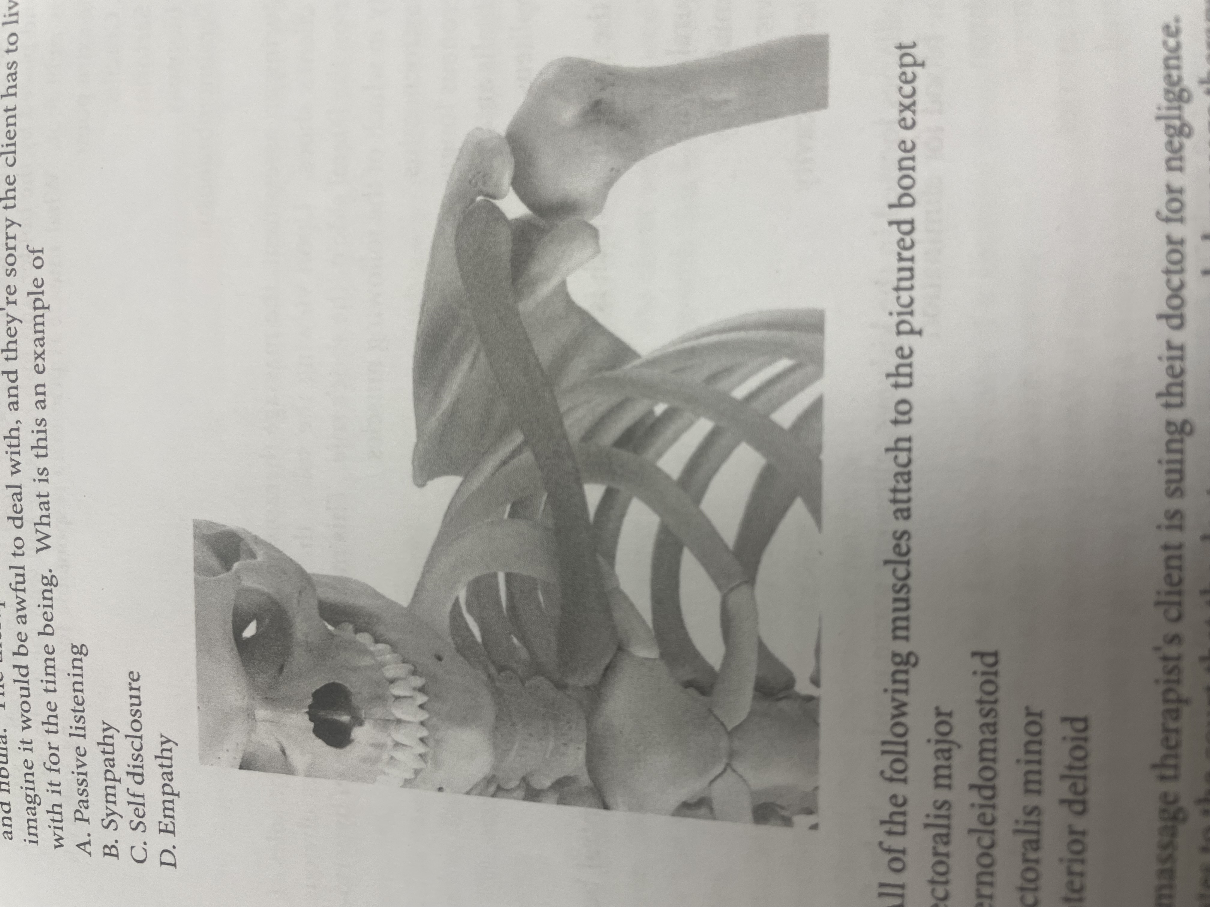 <p>All of the following muscles attach to the pictured none expect</p>