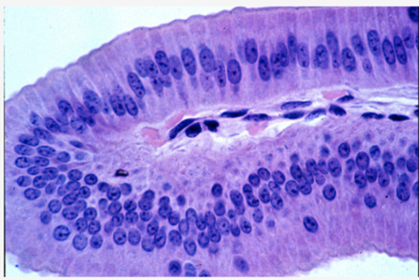 <p>Identify the type of epithelia</p>