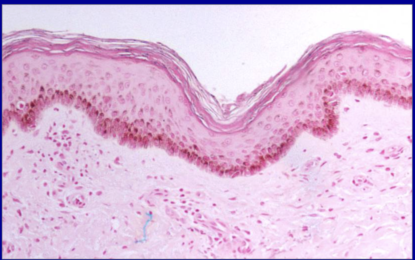 <p>ID the stain type </p>