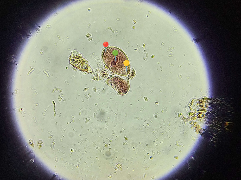 <p><span data-name="microbe" data-type="emoji">🦠</span><span data-name="cut_of_meat" data-type="emoji">🥩</span><span><span> </span></span><strong><em>Balantidium coli </em></strong><sub>(Trofozoit)</sub></p><p></p><p></p><p><span>🧩🦠 </span><strong>Organelle:</strong></p><p></p><ul><li><p><span>🔴 - cytostom;</span></p></li></ul><p></p><ul><li><p><span>🟢 - makronukleus;</span></p></li></ul><p></p><ul><li><p><span>🟡 - cytopyge.</span></p></li></ul><p></p><p><span>😷❓ </span><strong>Parazytoza:</strong> <em>Balantydioza</em></p>