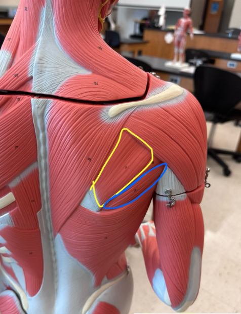 <p>What muscle is the yellow line indicating?</p>