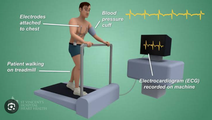<p>In the stress test, the ECG is recorded during a standardized exercise protocol with gradually increasing levels of exercise or with the patient at rest after the administration of dobutamine or dipyridamole;</p>