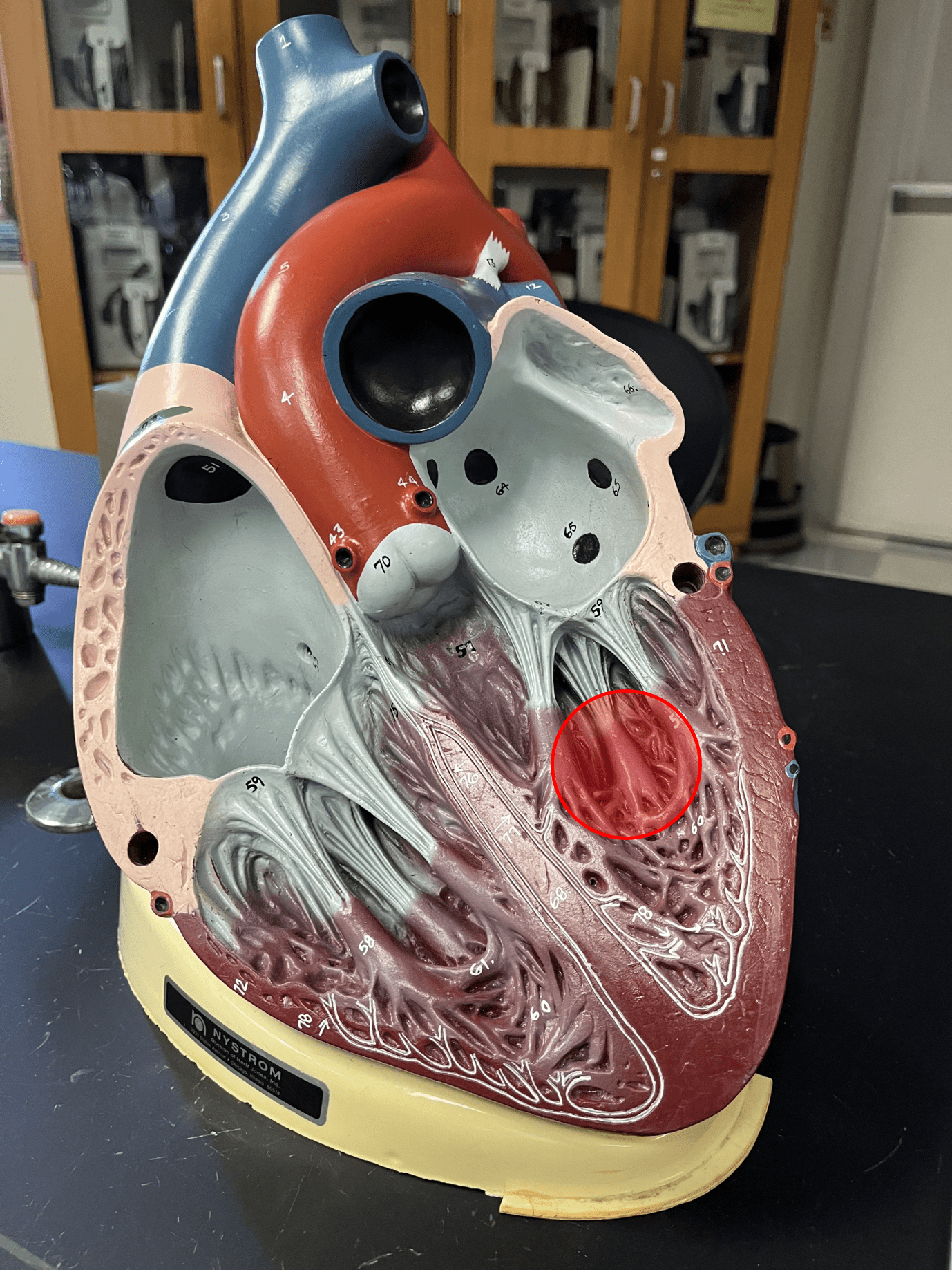• Cardiac muscle anchoring the chordae tendineae.

• Located in the ventricles of the heart.