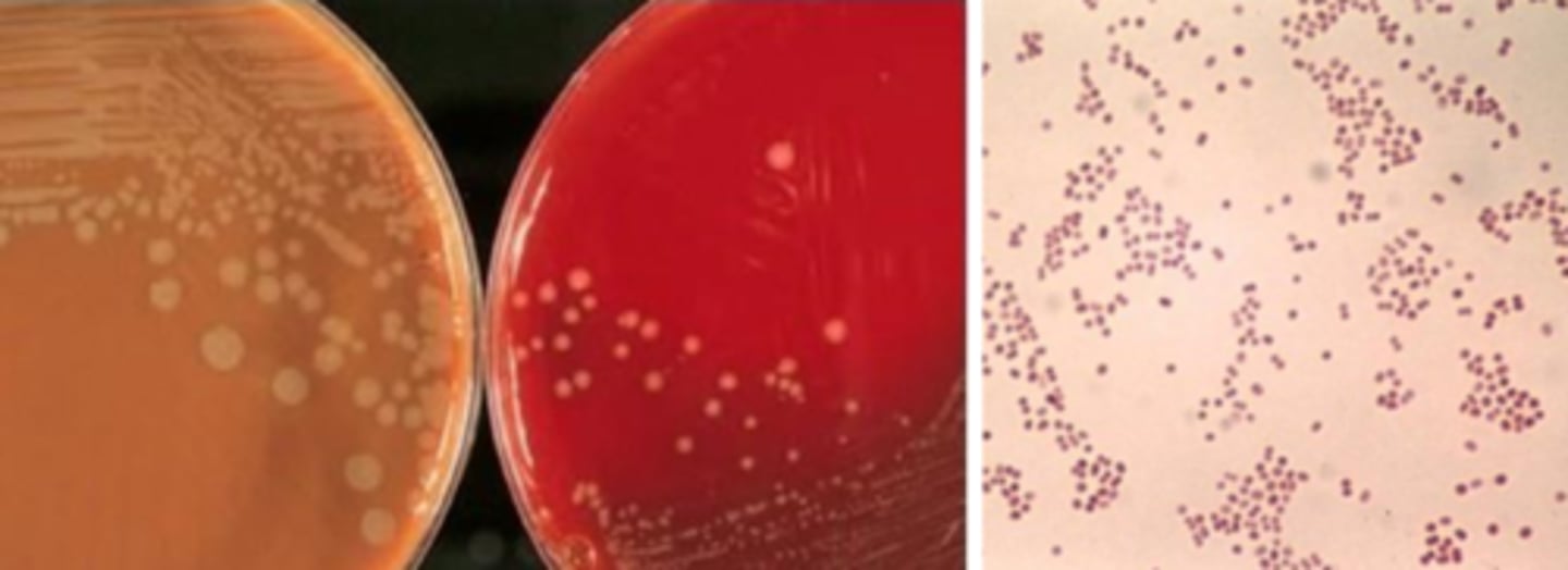 <p>Growth on blood, chocolate, Thayer Martin</p>