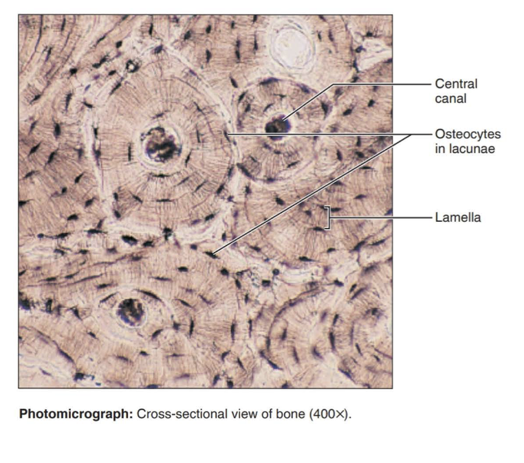 <p>Hard, calcified matrix containing many collagen fibers; osteocytes lie in lacunae. Very well vascularized.</p>