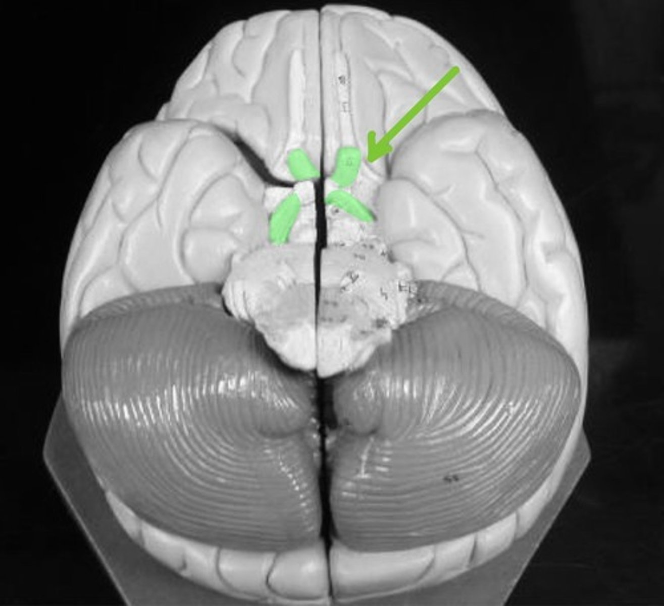 <p>Transmits VISUAL infromation to the brain.</p>
