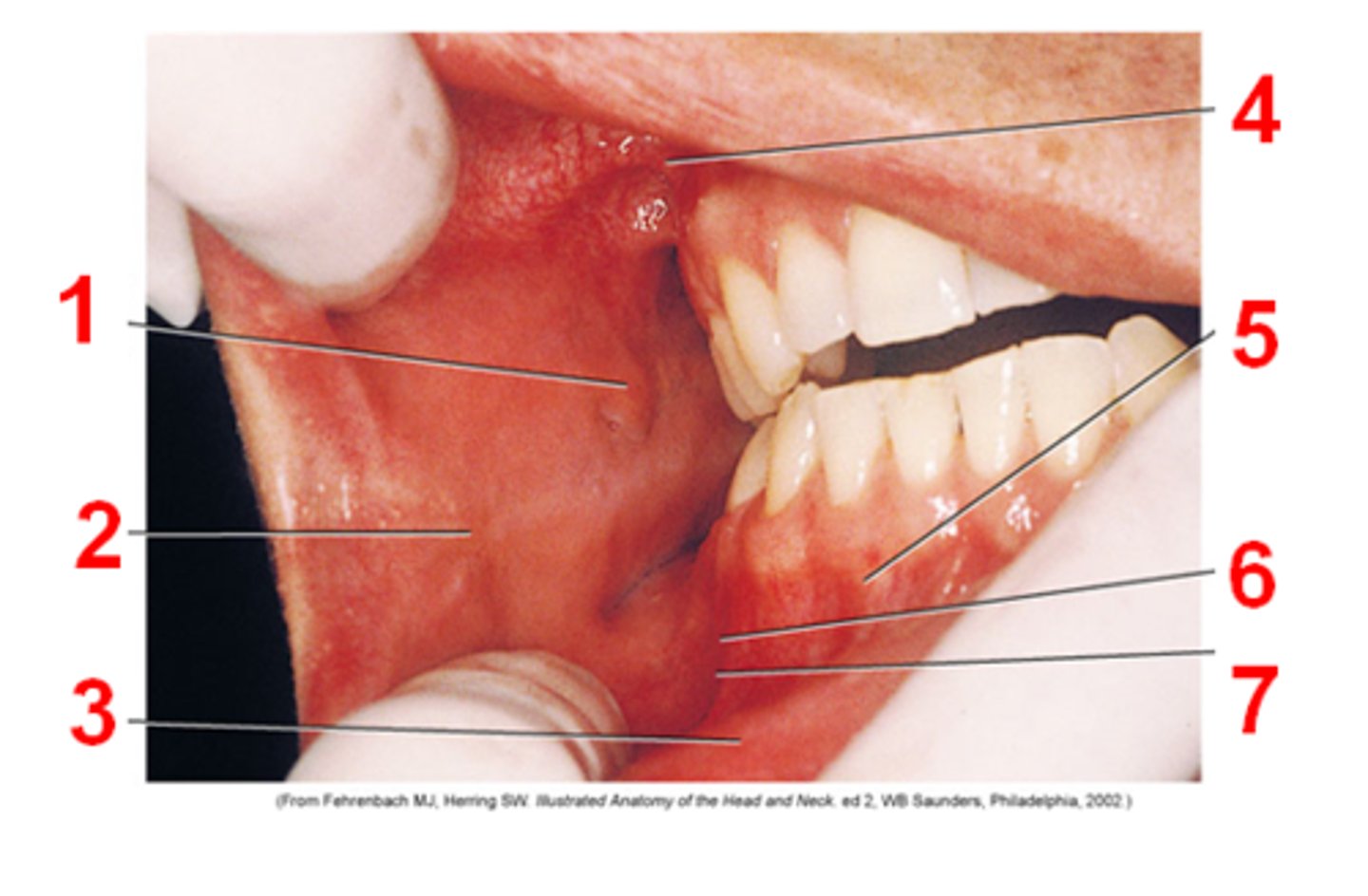<p>identify parts of the oral mucosa</p>