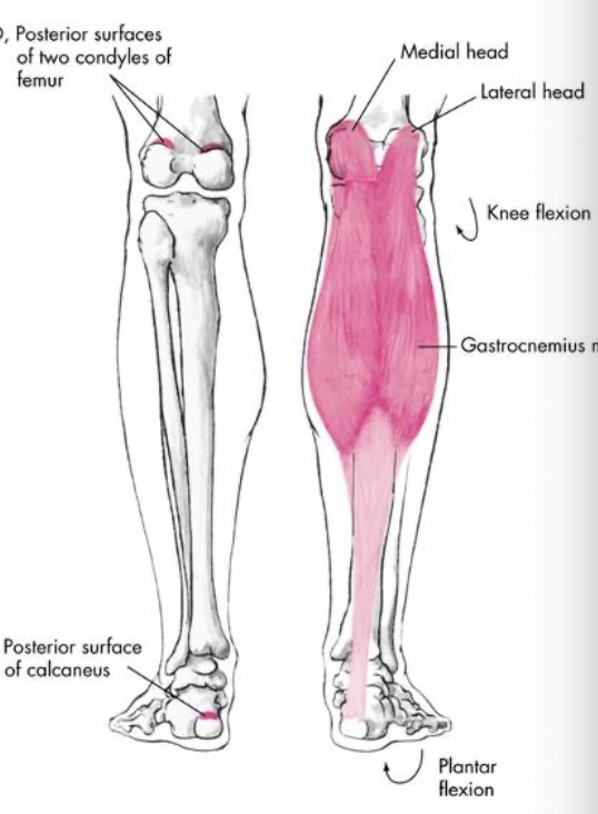 <p>Gastrocnemius</p>