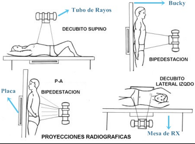 <ul><li><p>Conforme salga el haz de rayos x</p></li><li><p>Como se encuentra posicionado el cuerpo</p></li><li><p>El paciente cuando está de piel el aire asciende</p></li><li><p><strong>Decúbito supino: Frontal anteroposterior</strong></p></li><li><p><strong>Bipedestación:</strong></p><ul><li><p><strong>Anteroposterior</strong></p></li><li><p><strong>Posteroanterior</strong></p></li></ul></li><li><p><strong>Decúbito lateral izquierdo: Anteroposterior</strong></p></li></ul><p></p>