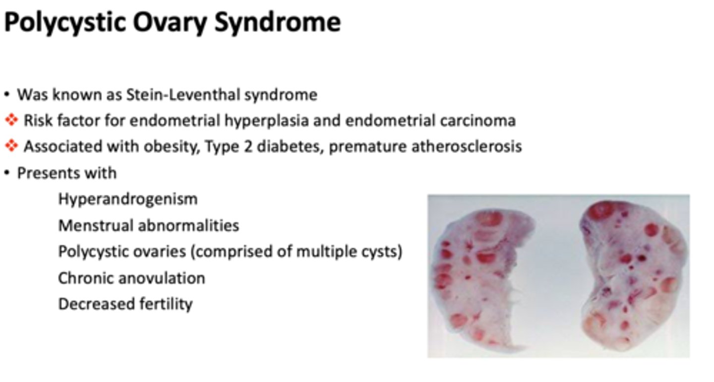 <p>polycystic ovary syndrome</p>