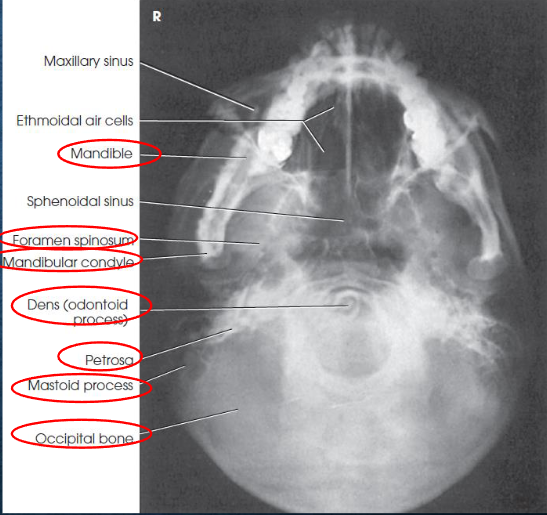 <ul><li><p>no rotation or tilt:</p><ul><li><p>equal distance from lateral border of skull to mandibular condyles</p></li><li><p>symmetric petrous pyramids</p></li></ul></li><li><p>penetration sufficient to demonstrate structures of cranial base</p></li><li><p>superimposition of mental protuberance over anterior frontal bone, indicating full neck extension</p></li><li><p>mandibular condyles anterior to petrous pyramids</p></li></ul><p></p>