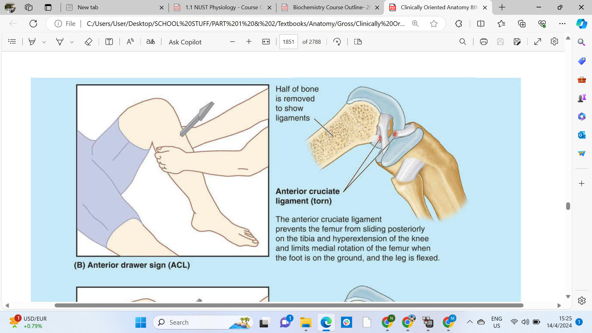 <p><span>The anterior drawer test is a physical examination maneuver used to assess the integrity of the anterior cruciate ligament (ACL) in the knee.</span></p>