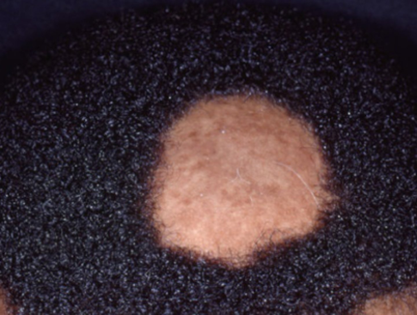 <p>What is the diagnosis?</p>