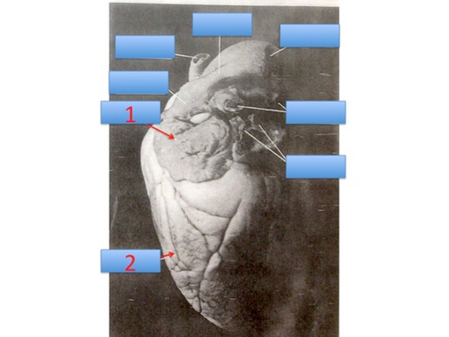<p>This is the POSTERIOR view. What is 1 pointing to?</p>