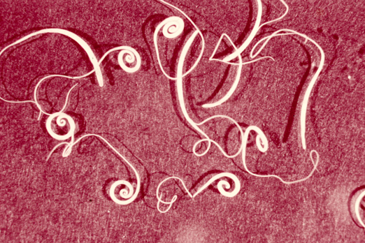<p>Whipworms - "Hair tail"</p><ul><li><p>Found: Worldwide​</p></li><li><p>Cause of infection: Ingestion of infective ova​</p></li><li><p>Adults in cecum and colon​</p></li><li><p>Unembryonated eggs with bipolar plugs</p></li></ul><p></p>