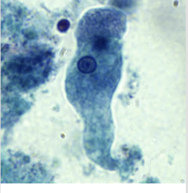 <p>no RBCs present</p>