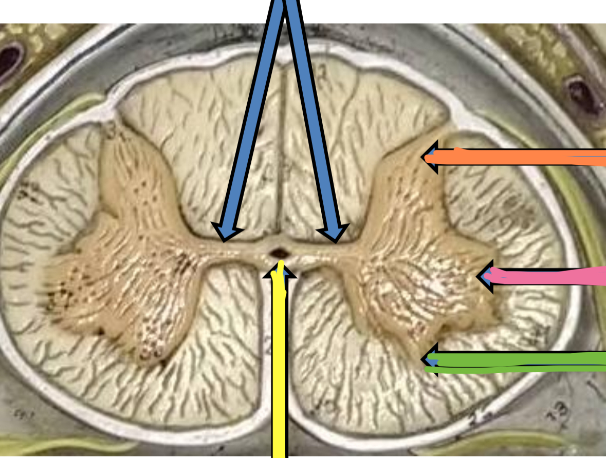 <p>Pink points to what spinal cord horn</p>