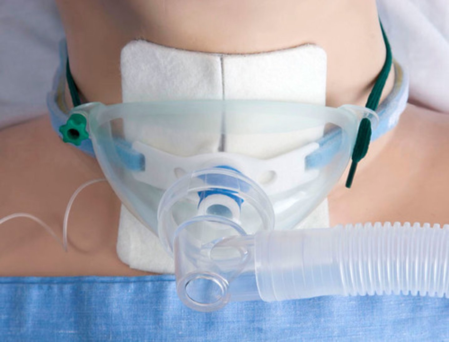 <p>surgical creation of an opening into the trachea through the neck</p><p>- permanent</p>