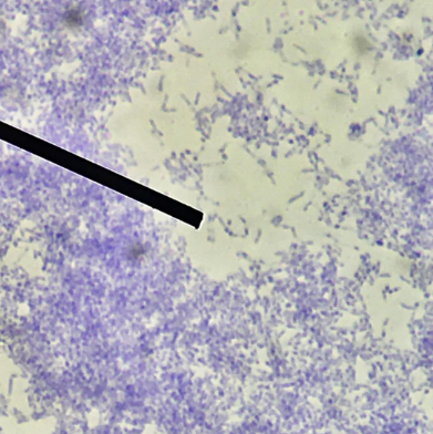 <p>What is the virulence mechanism of this special structure?</p>