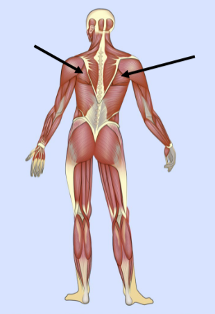 <p>What major muscle is this?</p>