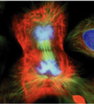 <p>what stage of mitosis?</p>