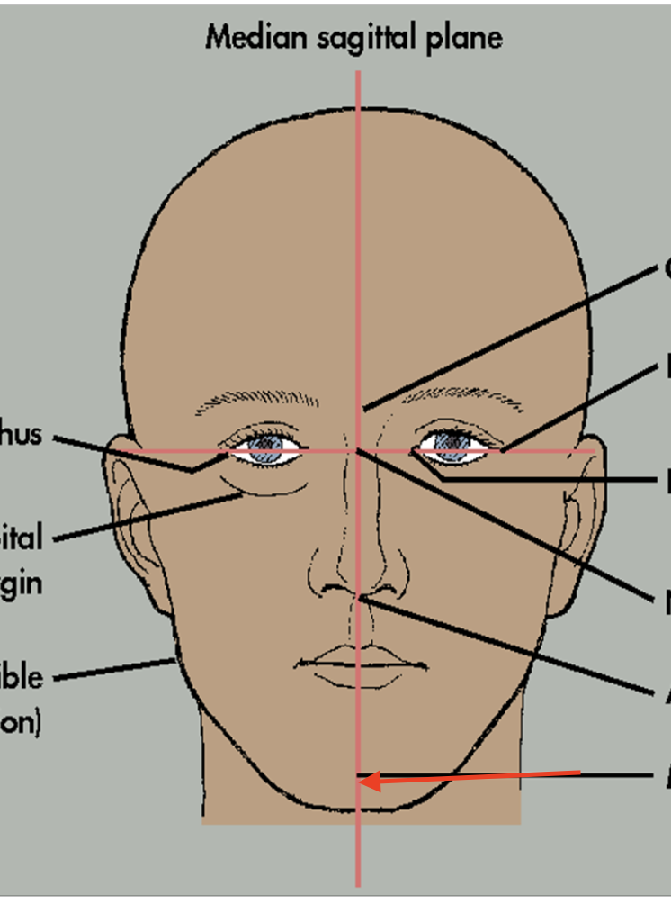 term image
