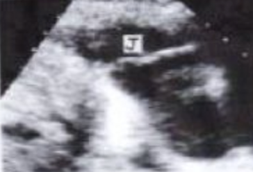 <p>J?</p>