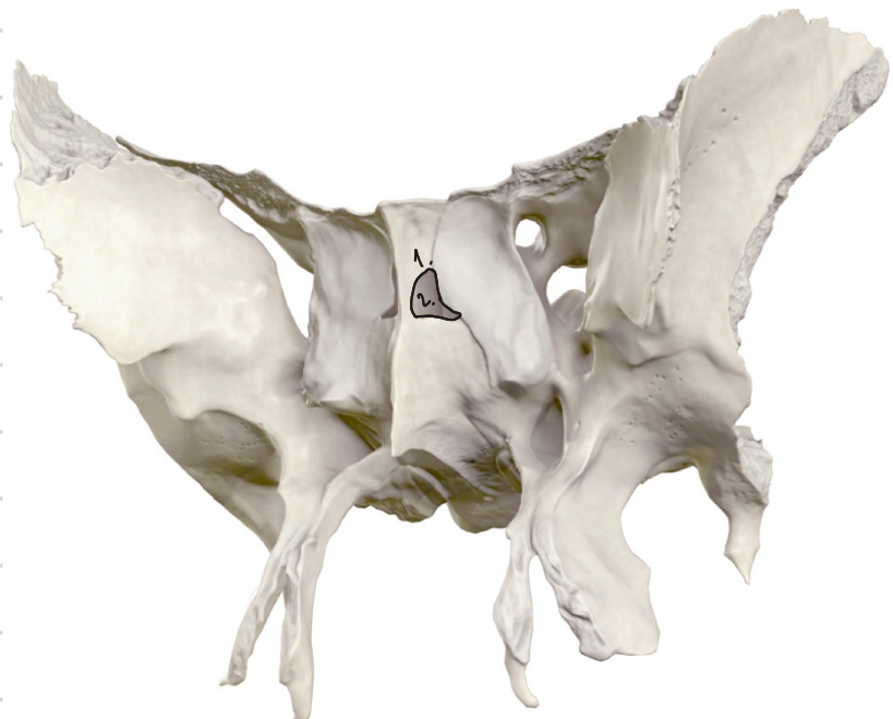 <p>Priekšējā virsma:</p><ol><li><p>aperatura sinus sphenoidalis (2)</p></li><li><p>sinus sphenoidalis (2) (gaisu saturošs dobums)</p></li><li><p>septum sinuum sphenoidalium</p></li></ol><p>Apakšējā virsma:</p><ol start="4"><li><p>pie tās piestiprinās lemesis<em> vomer</em></p></li></ol><p>Mugurējā virsma:</p><ol start="5"><li><p>piestiprinās vomer</p></li></ol><p></p>
