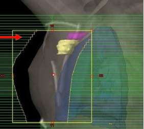 <ul><li><p>MV portal image</p></li></ul><p></p>