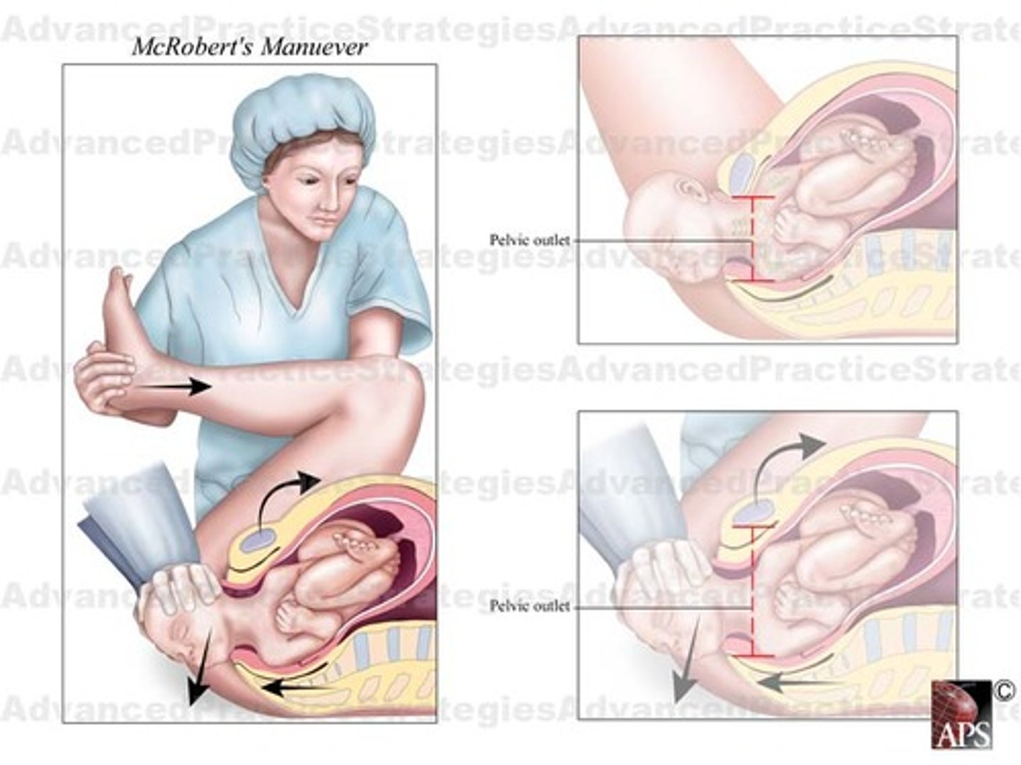 <p>Pull knees to head to open up pelvis.</p>