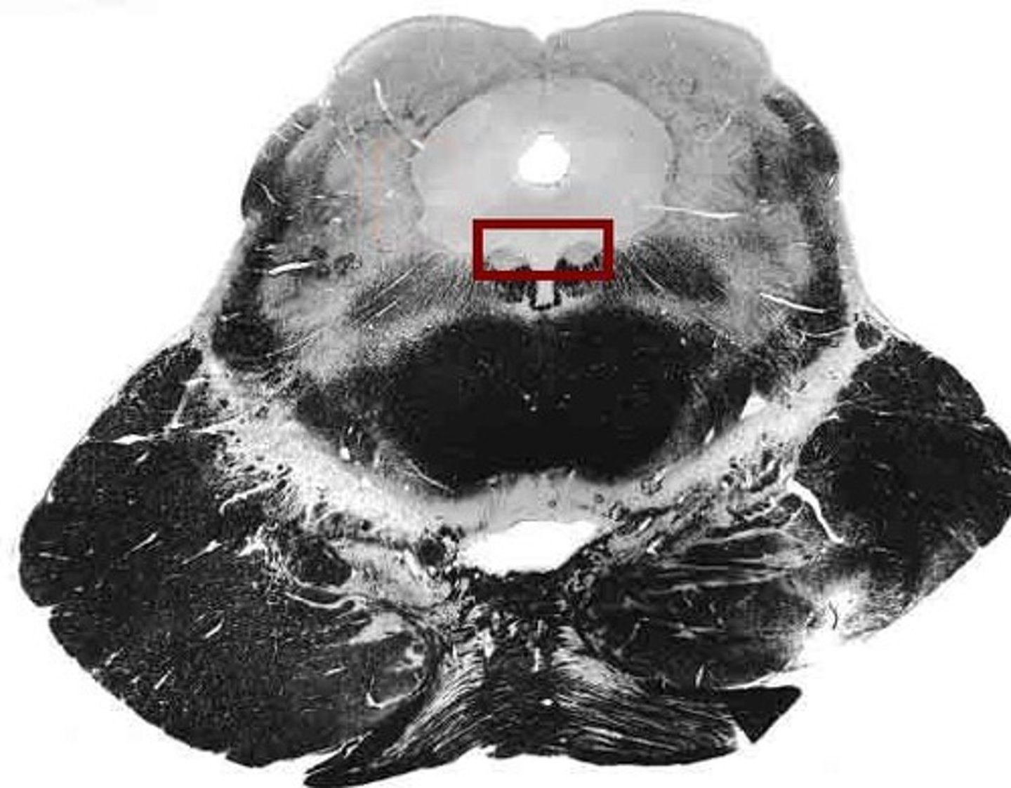 <p>controls superior oblique eye muscles</p>