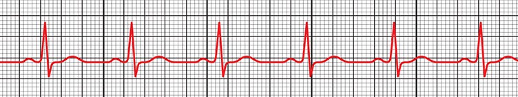<p>What rhythm is this?</p>