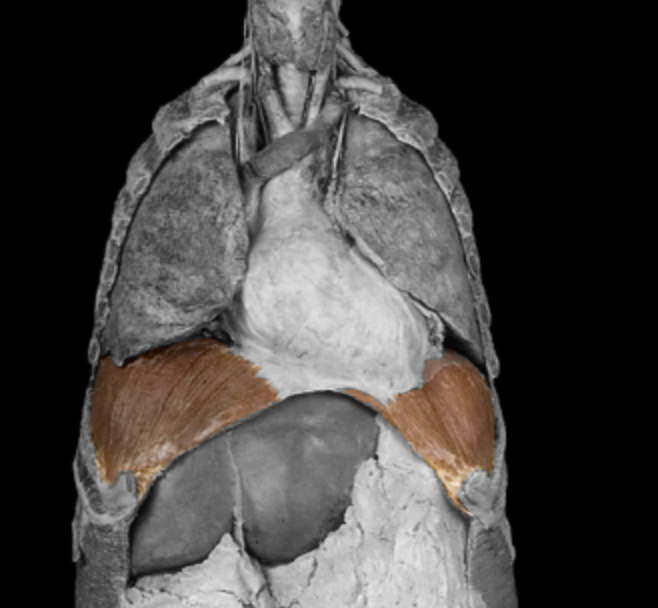 <p>What muscle is this? </p>