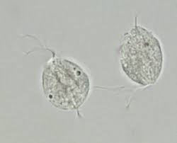 <p><strong>pathogenic (urogenital)</strong> </p><ul><li><p><strong>Type</strong>: Flagellate</p></li><li><p><strong>ID</strong>: <strong>Only troph stage</strong>, found in <strong>urine, vaginal/prostatic secretions</strong>; sexual transmission.</p></li><li><p><strong>Symptoms</strong>: Women — itching, burning, dysuria, <strong>foamy yellow-green discharge</strong> with odor. Men — often asymptomatic; may have prostatitis/urethritis.</p></li><li><p><strong>Testing</strong>: Direct wet prep for motile trophs; (molecular/antigen tests exist, but your deck emphasizes wet prep recognition).</p></li></ul><p></p>