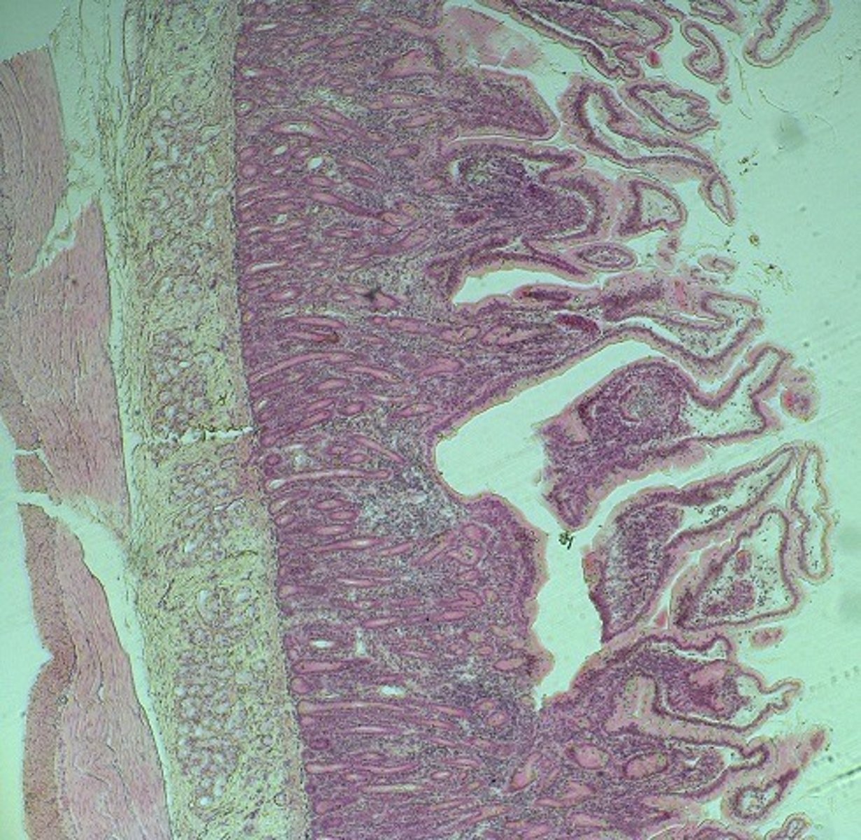 <p>This is a slide of what region of the GI tract?</p>