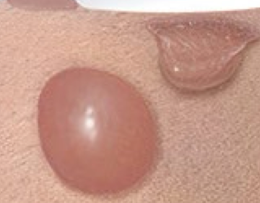 <p>what bulla is depicted on the right</p>