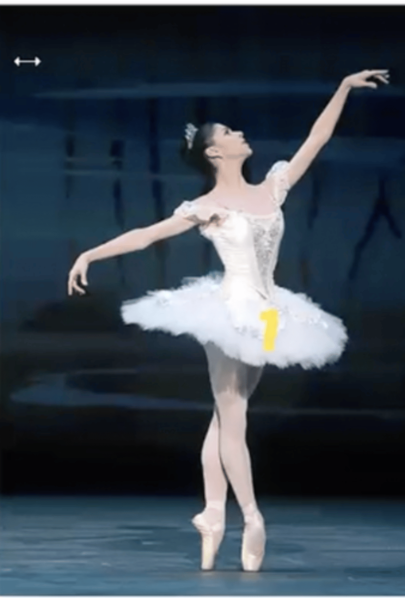 <p>pelvis: retraction (hip hike)</p><p>hip: adduction (scissoring), IR, extension</p><p>knee: extension</p><p>foot and ankle: PF, inversion, equinovarus, toes claw, toes curl</p><p>THINK OF A BALLERINA</p>