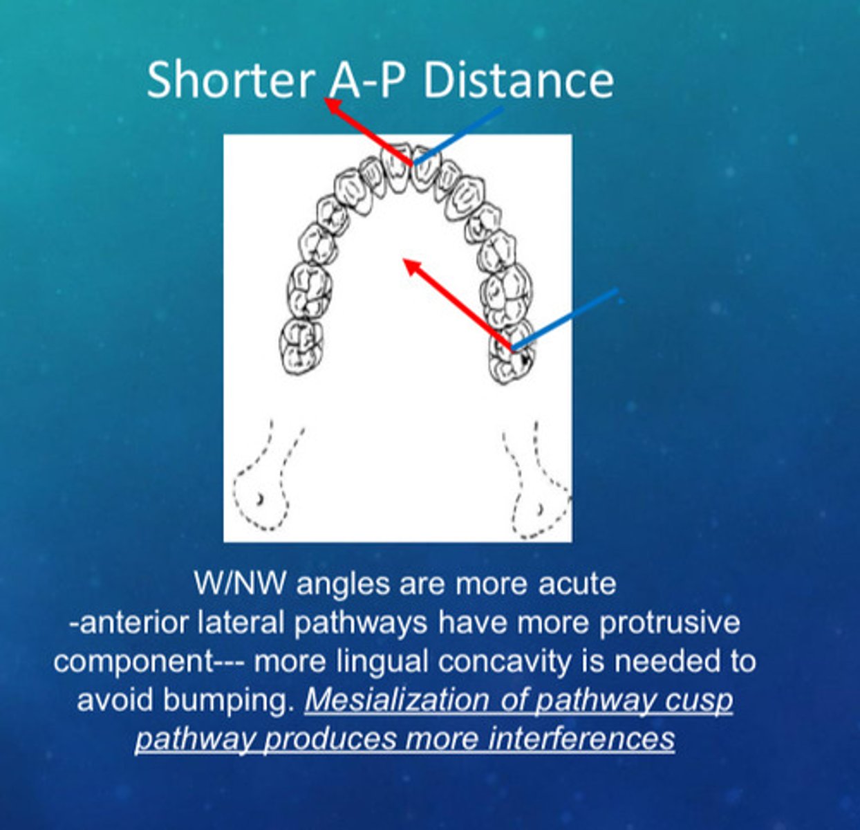 <p>1) W/NW angles are more acute</p><p>2) anterior lateral pathways have more protrusive component</p><p>3) more lingual concavity is needed to avoid bumping</p><p>4) mesialization of cusp pathway produces more interferences</p>