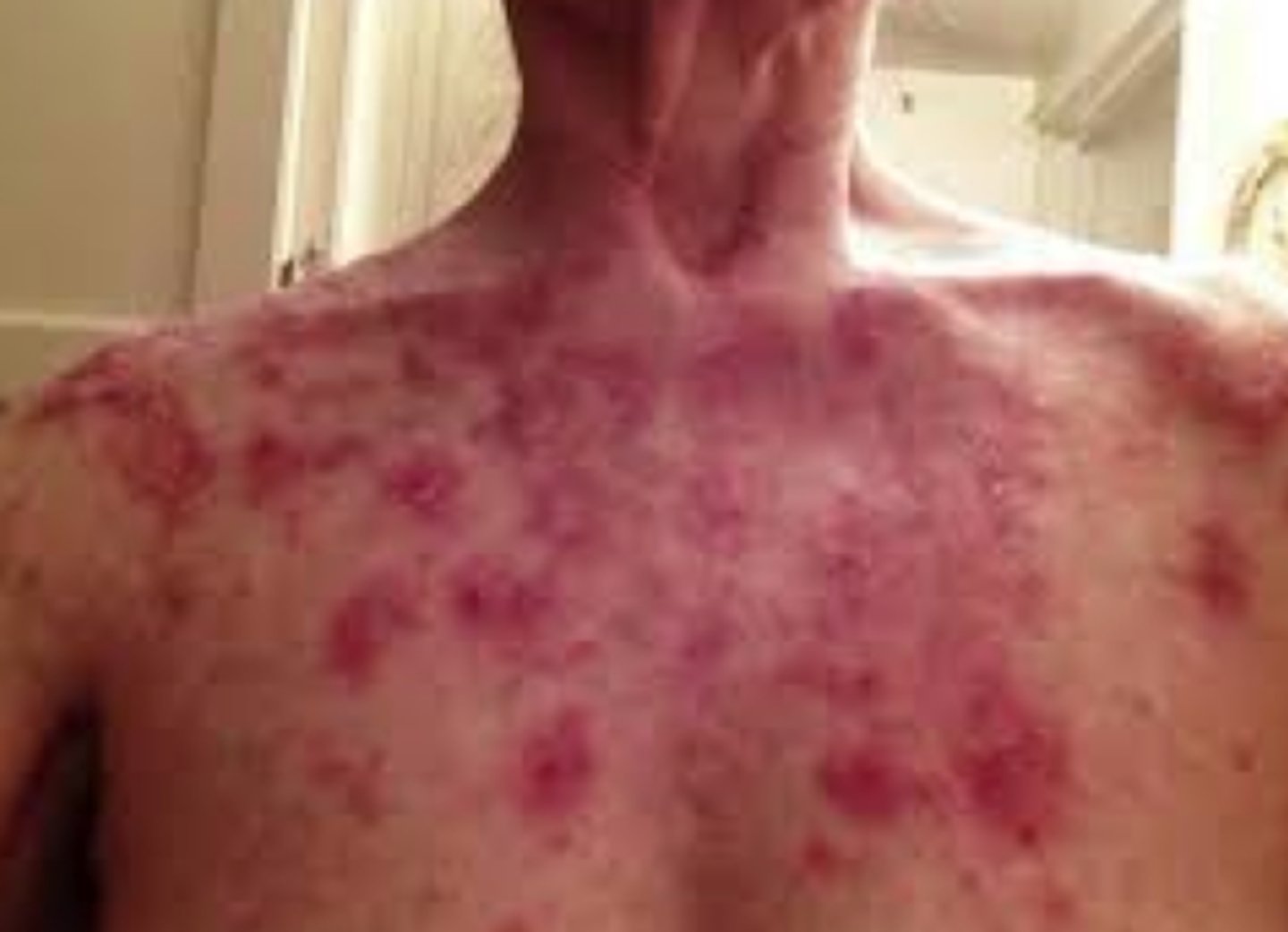 <p>What is the diagnosis?</p>