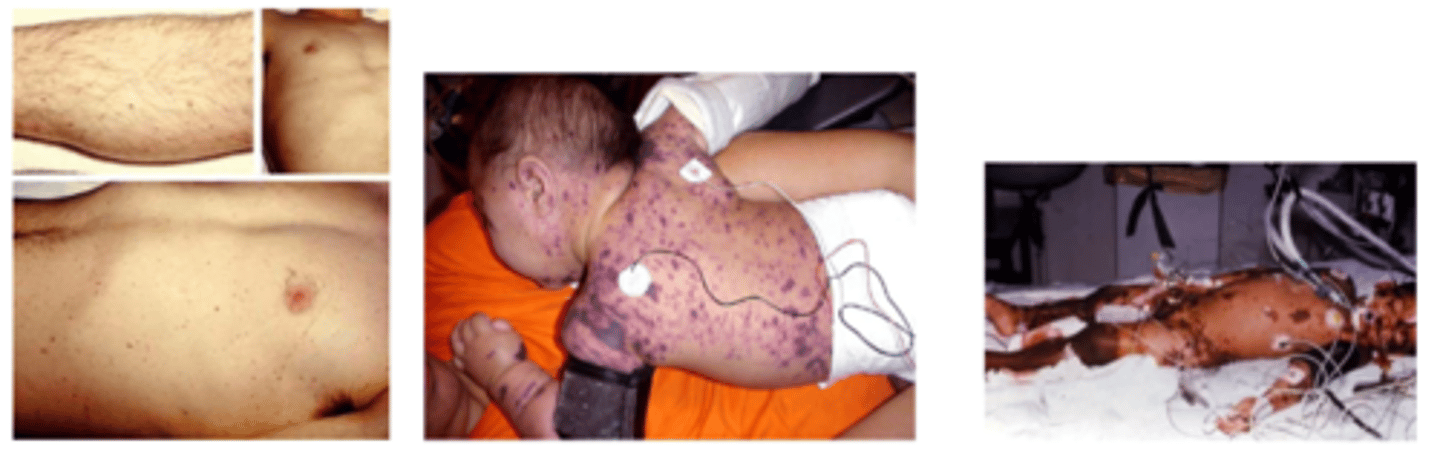 <p>- is there a rash? when did it start?</p><p>- what is the distribution, what does it look like?</p><p>petechial rash = bleeding (what is occurring internally?)</p>