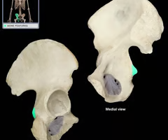 sharp, slender, often pointed projection