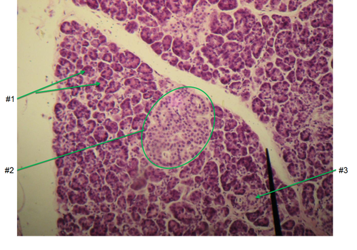 <p>#1 in diagram; clusters of exocrine cells which produce digestive enzymes</p>