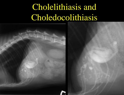 <p>Gallbladder disease  on Radiographs </p>