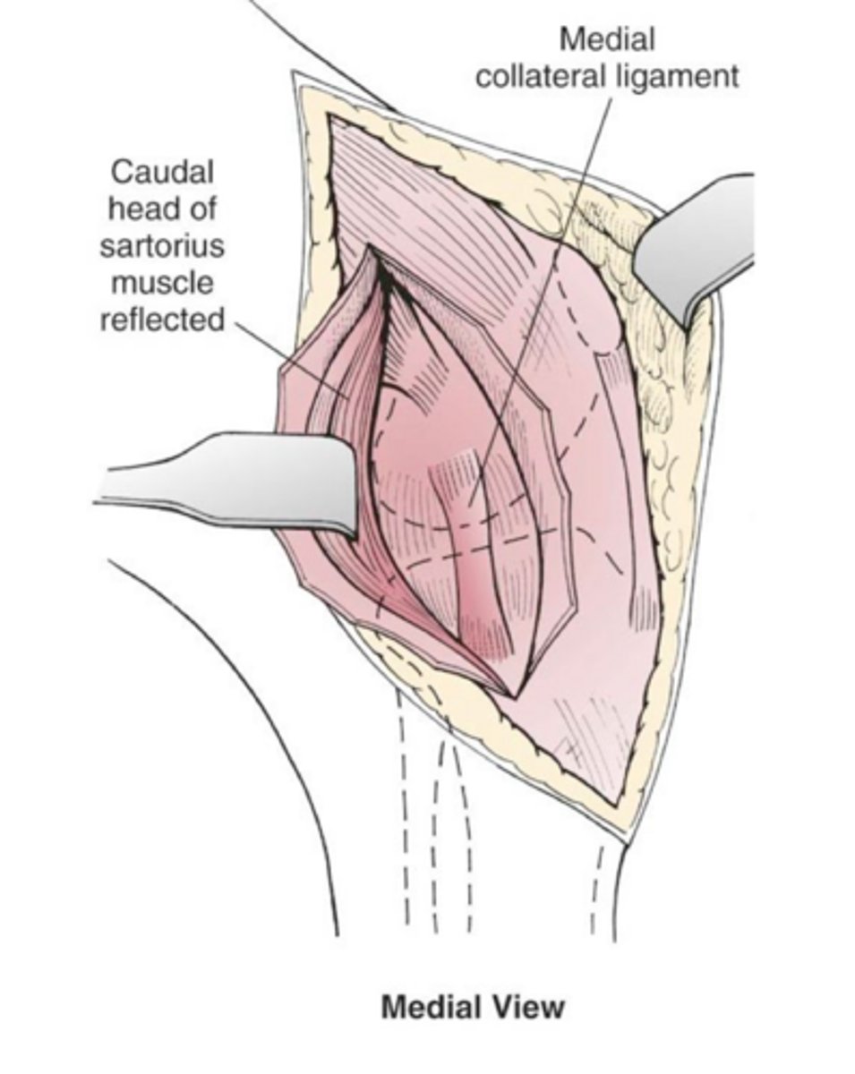 <p>general function for medial and lateral collateral ligaments</p>