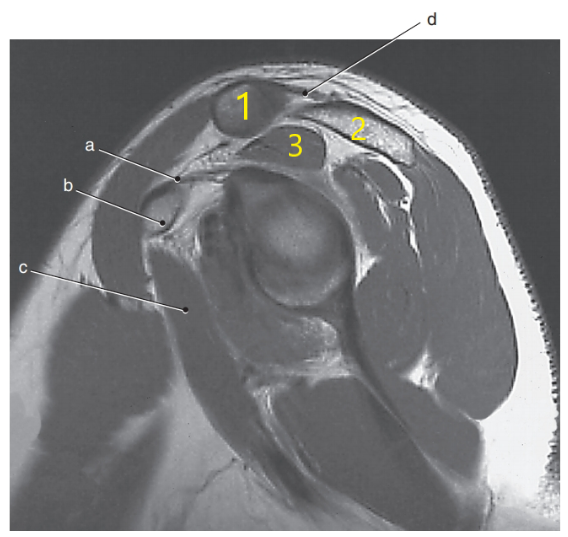 <p>What is letter d ?</p>