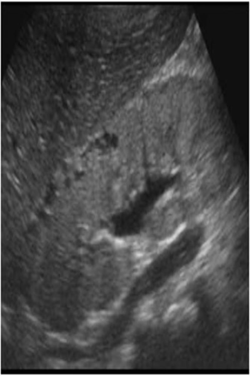 <p>infantile</p>
