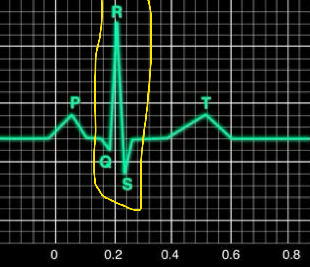 <p>Ventricular depolarisation</p><ul><li><p>bundle of His/purkinje fibres undergo depolarisation</p></li><li><p>2 ventricles will contract soon</p></li><li><p>Atrial repolarisation</p></li></ul>