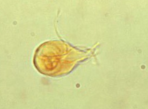 <p>Intestinal parasite, fecal contamination</p>